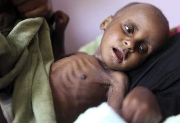 UN warns of imminent "worst famine" in Yemen amid US threats