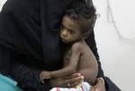 3,800 Yemeni minors killed, thousands suffer malnutrition over Saudi-led war
