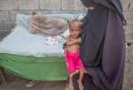 یمنی اہلکار نے العالم کو انٹرویو دیتے ہوئے کہا: ہر 10 منٹ میں ایک یمنی بچہ مرتا ہے