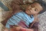 دفتر حقوق بشر سازمان ملل شهادت کودک 8 ساله یمنی را محکوم کرد