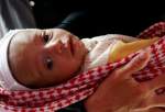 Malnutrition threatening lives of half a million Yemeni children(Photo)  