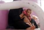 تعلیق برنامه پیشگیری از سوء تغذیه در یمن از سوی آژانس غذای سازمان ملل