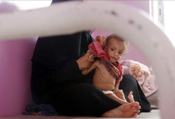 UN food agency decides to suspend malnutrition prevention program in Yemen